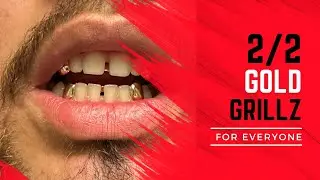 The Rise of Gold Fangs and Their Cultural Impact