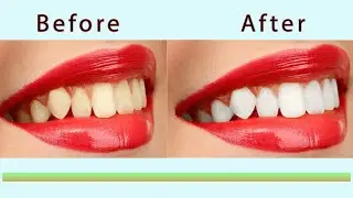 How To Whiten Your Teeth | Adobe Photoshop Tutorial | #Photoshop