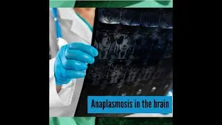 Anaplasmosis causes neurologic problems