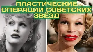 Неудачные пластические операции советских звёзд