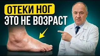 Swollen legs – check these 3 points right now. If a dimple remains, see a doctor!