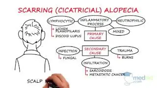 Dermatology - Alopecia: By Najwa Somani M.D.
