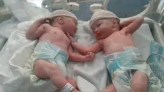 刚出生的双胞胎宝宝，面对面地躺着，太有爱了（Newborn twin babies, lying face to face, so loving）