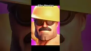 Mewing Transformation
