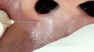 Relaxing Medical and Derm Video! Best Educational Health