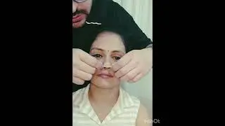 NASAL MASSAGE , DIGITAL COMPRESSION AND TAPING AFTER RHINOPLASTY OR NOSE JOB SURGERY!