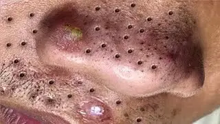 تلميع وتنظيف الجلد الطبيعي المدور 1413592