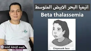 انيميا البحر الابيض المتوسط / Beta thalassemia