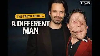 Adam Pearson on A Different Man: Beauty, Disability, and Sebastian Stan