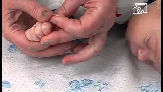 Ноготки