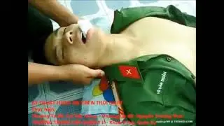 Male CPR 01