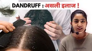 Dandruff:असली इलाज़ |Alka Thakur |