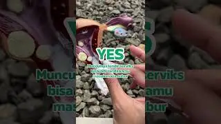 Cek Masa Subur Dari Lendir?