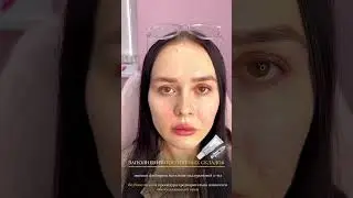 #воронеж #косметолог
