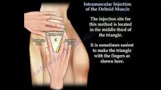 Deltoid Intramuscular injection - Everything You Need To Know - Dr. Nabil Ebraheim