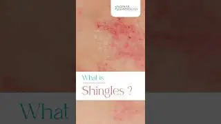 Unmasking the Pain: Shingles Awareness | Did You Know? 🕵️‍♂️