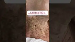 А вы любите загорать? #owell #коллаген #уходзакожей #косметолог #загар