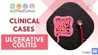 Ulcerative Colitis Clinical Case