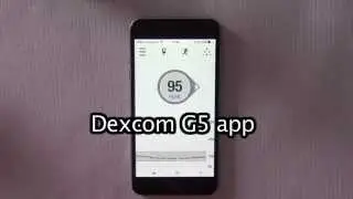 Dexcom G5 app