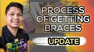 PROCESS OF GETTING BRACES | UPDATE | NORHASIM OMAR