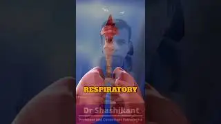 The Truth About Status Asthmaticus: Asthma Emergency Revealed!#pathology #viralshorts