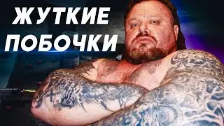 THE TERRIBLE CONSEQUENCES OF ANABOLIC STEROIDS / Dr. Anabolic