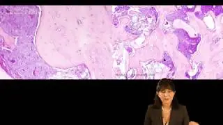 Severe Atrophic Anterior Maxilla: Advantages of Combined Therapy - Part 1 of 2