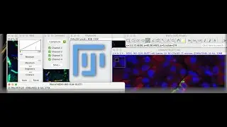 Introduction to Fiji for image processing and analysis
