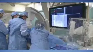 Uterine Fibroid Embolization
