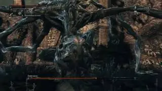 Bloodborne Амигдала