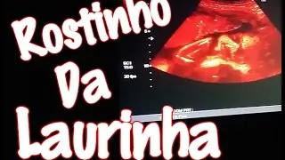 VIMOS O ROSTINHO DA NOSSA FILHA  -ULTRASSOM MORFOLÓGICO