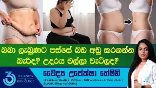 බබා ලැබුණට පස්සේ බඩ අඩු කරගන්න බැරිද උදරය එල්ලා වැටිලද? | 360 wellness & Skin Clinic