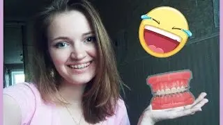 Мои брекеты. Установка. Ощущения.