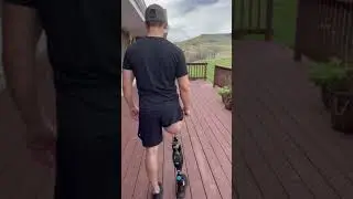 Joe walking 4 months post osseointegration surgery