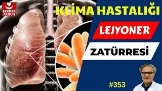 353. Klima hastalığı, Zatürre, Lejyoner hastalığı nedir?,Nasıl bulaşır?, Nasıl bulundu?