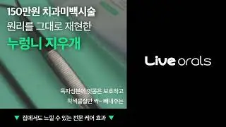 하루 1000원에 치과미백 맛보기