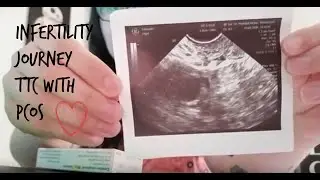 My Infertility Journey! Miscarriage, Trying Again, Clomid. PCOS