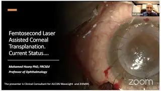 Cornea - To The Wonderland- Femtolaser keratoplasty - Prof. Mohamed Hosny