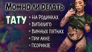 Можно ли делать тату при заболеваниях кожи? Тату на родинках и акне