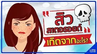 ภัยของ สเตรียรอย ในครีมที่คุณต้องรู้