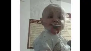 Опухоль мозга у малышки
