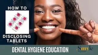🦷5✨️How to See Plaque | Disclosing Tablet | Smyle Therapy Plaque Test or Plaque Revealer Demo
