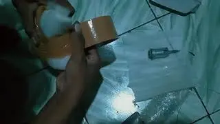 Bungkus ecu dan immobilizer zafira