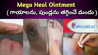 Mega Heal Ointment Uses in Telugu| గాయాలను, పుండ్లని తగ్గించే మెగా హీల్  జెల్ ఉపయోగాలు.