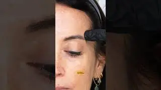 You need to know this before injecting the temples