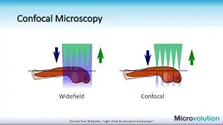 Moving to a Real-Time Image Processing Workflow for 3D Fluorescence Microscopy