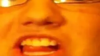 GAG