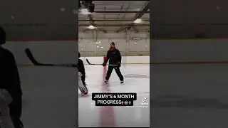 Jimmy’s 6 month progress🙌🏼🙌🏼