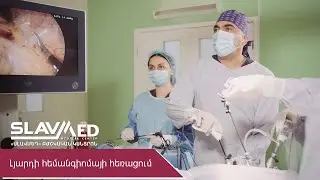 Լյարդի հեմանգիոմայի հեռացում