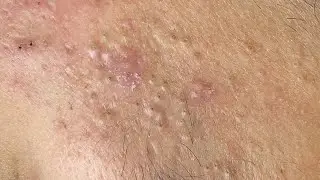 Satisfying Relaxing with Sac Dep Spa 